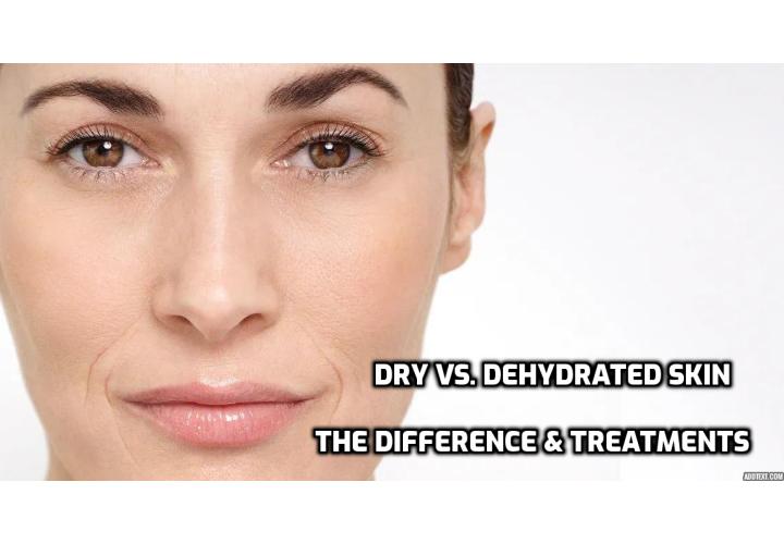 Dry Vs. Dehydrated Skin – What’s The Difference and Treatments. To put it simply: Dry skin lacks oil, while dehydrated skin lacks water. Read on here to learn the different treatments for dry skin and dehydrated skin.