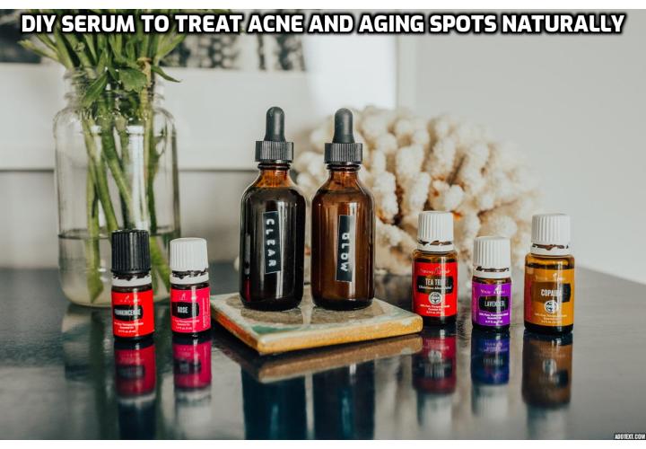 DIY Serum to Treat Acne and Aging Spots Naturally - In this recipe, we’ll create a simple DIY serum you can use to spot treat acne scars. However, it’s also great for treating aging spots (and smells delicious!)